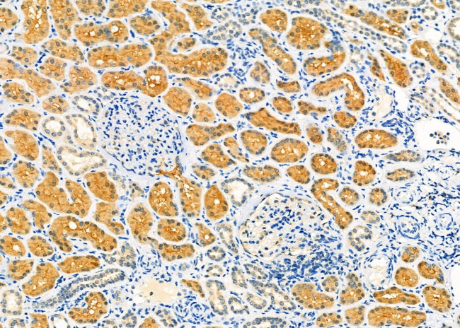 Aquaporin 9 Antibody in Immunohistochemistry (Paraffin) (IHC (P))