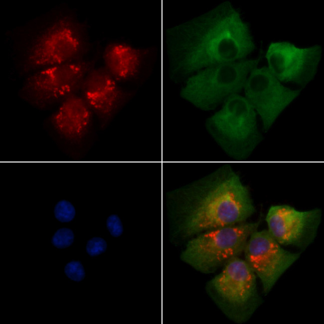 ARF1/ARF3/ARF5/ARF6 Antibody in Immunocytochemistry (ICC/IF)