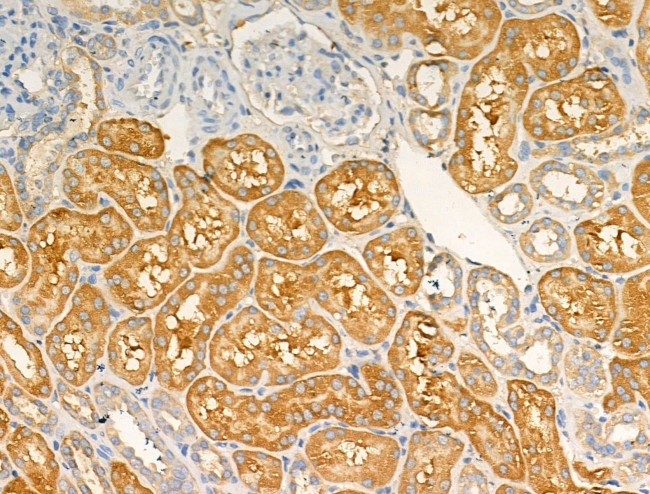 ARF1/ARF3/ARF5/ARF6 Antibody in Immunohistochemistry (Paraffin) (IHC (P))