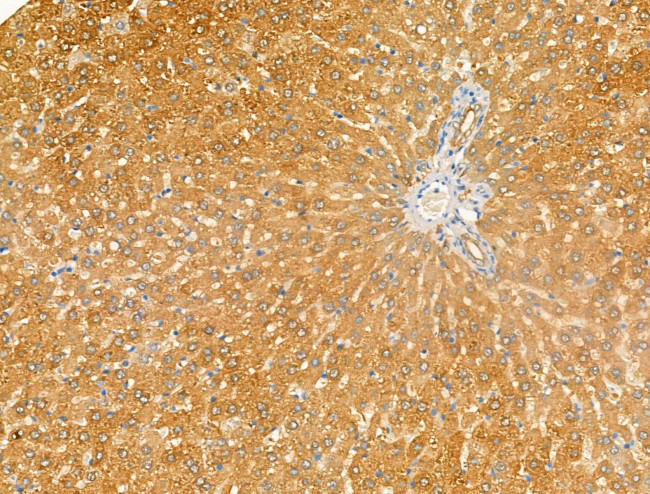 ARF1/ARF3/ARF5/ARF6 Antibody in Immunohistochemistry (Paraffin) (IHC (P))