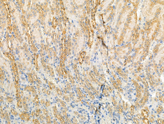 ARF1/ARF3/ARF5/ARF6 Antibody in Immunohistochemistry (Paraffin) (IHC (P))