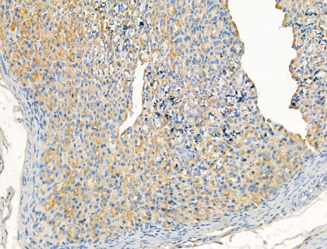 ARF1/ARF3/ARF5/ARF6 Antibody in Immunohistochemistry (Paraffin) (IHC (P))