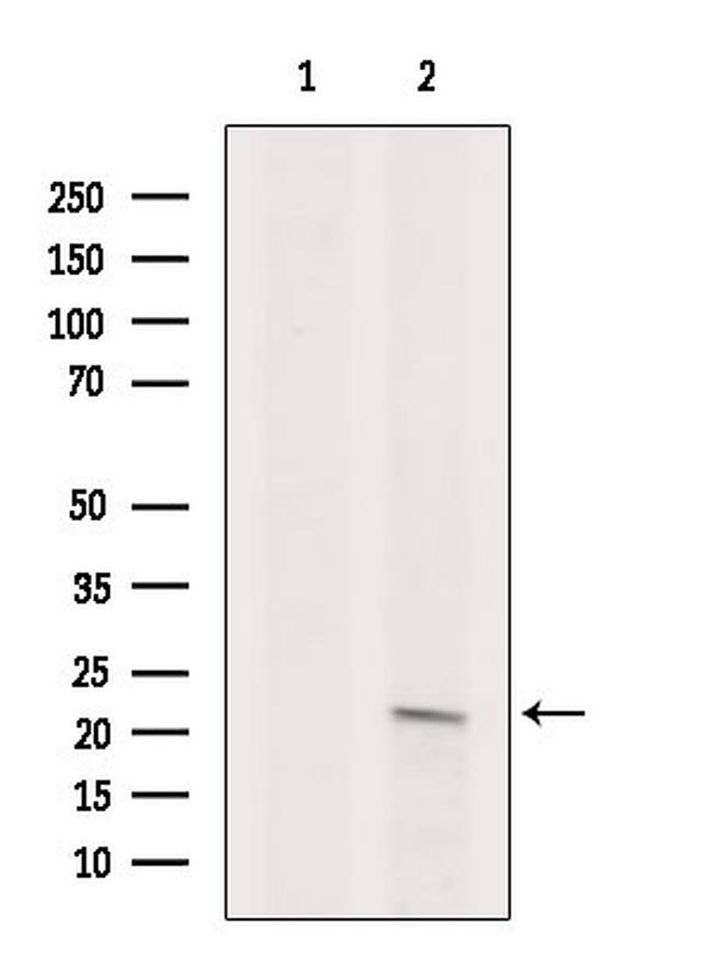 ARF1/ARF3/ARF5/ARF6 Antibody in Western Blot (WB)