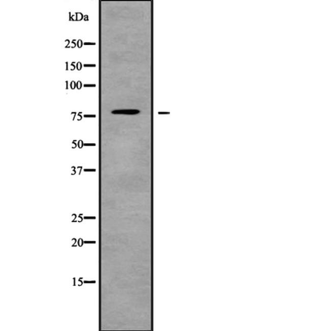 ARHGEF4 Antibody in Western Blot (WB)