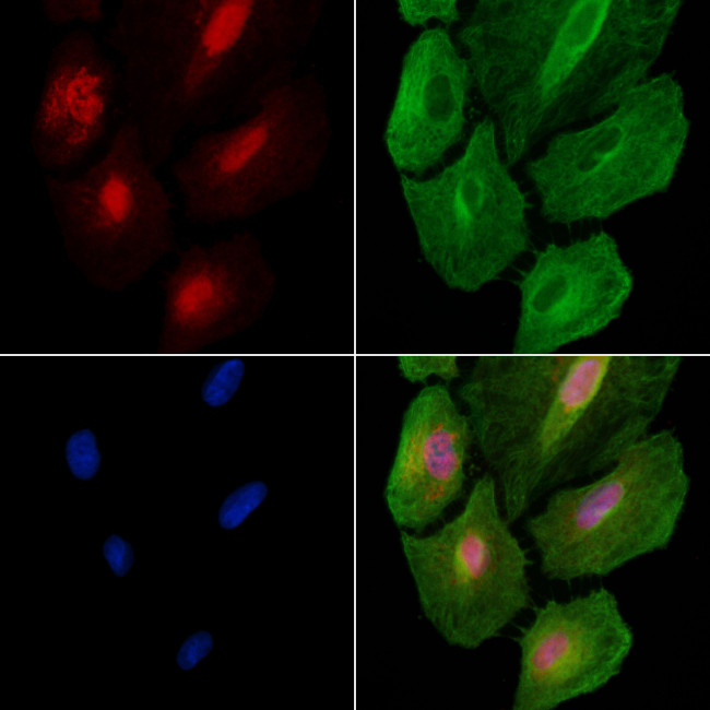 ARID1A Antibody in Immunocytochemistry (ICC/IF)