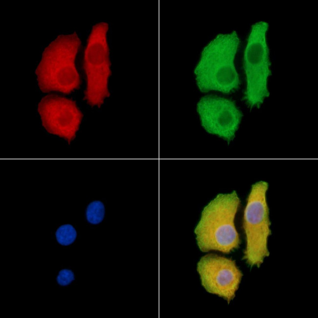 ASAP1 Antibody in Immunocytochemistry (ICC/IF)