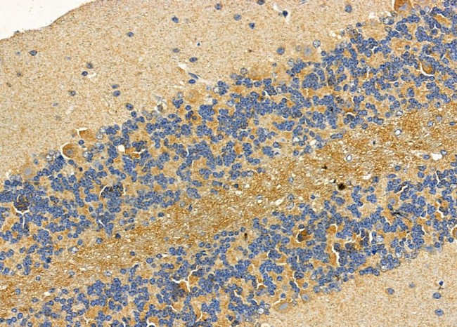 ASAP1 Antibody in Immunohistochemistry (Paraffin) (IHC (P))