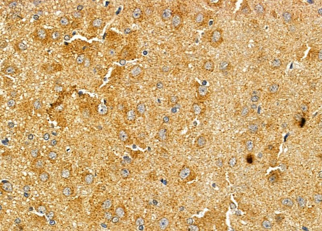 ASAP1 Antibody in Immunohistochemistry (Paraffin) (IHC (P))