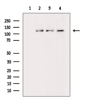 ASAP1 Antibody in Western Blot (WB)