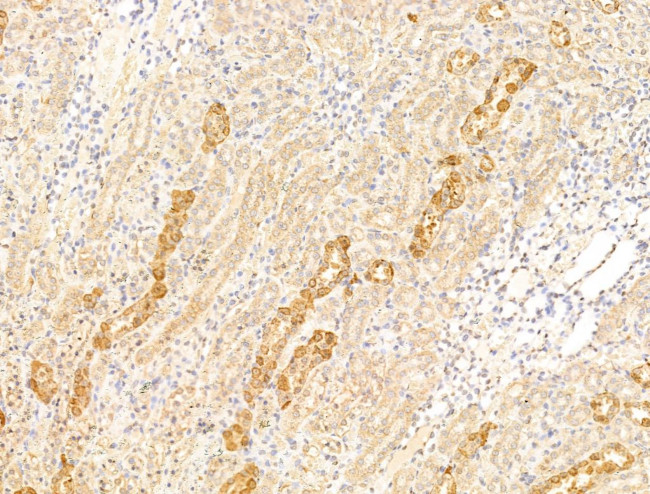 Asporin Antibody in Immunohistochemistry (Paraffin) (IHC (P))