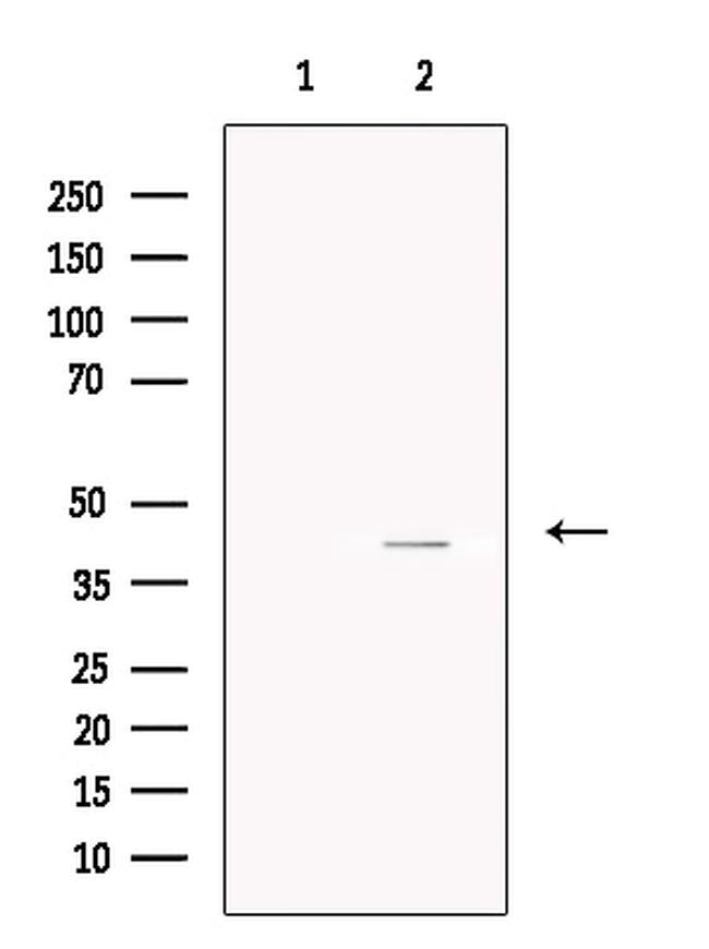 Asporin Antibody in Western Blot (WB)