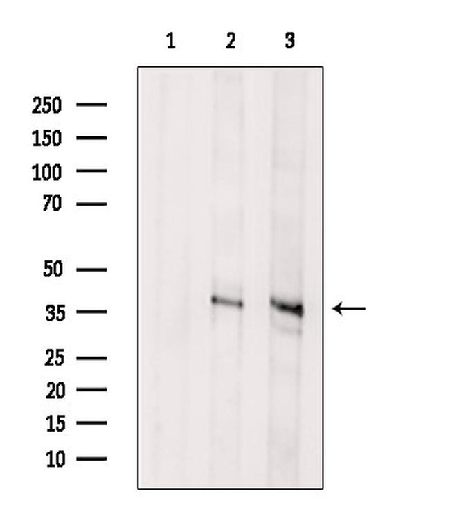 Asporin Antibody in Western Blot (WB)