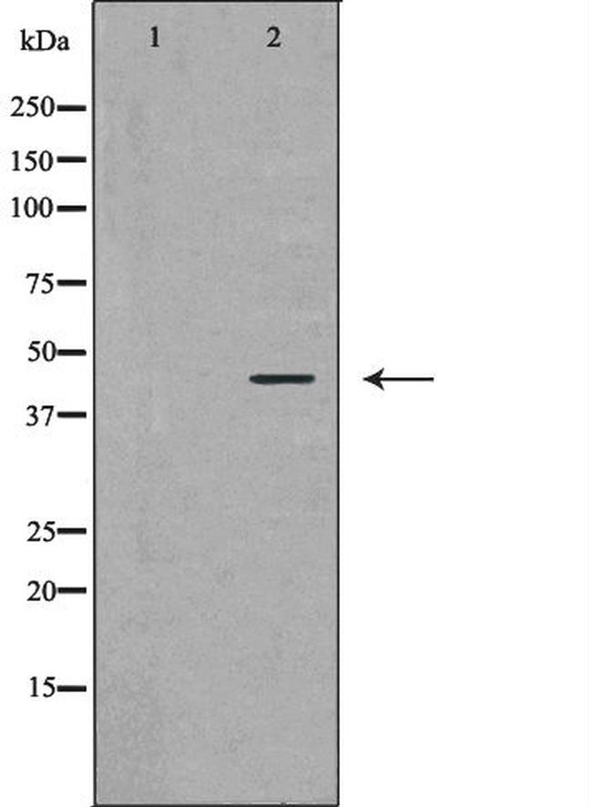 Ataxin 3 Antibody in Western Blot (WB)