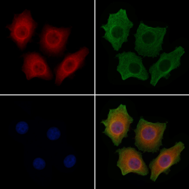 ATF6 Antibody in Immunocytochemistry (ICC/IF)