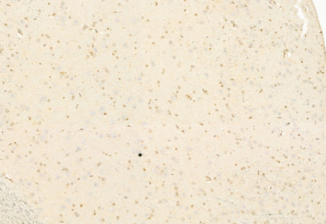 ATF6 Antibody in Immunohistochemistry (Paraffin) (IHC (P))