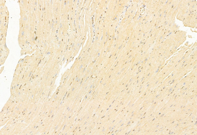 ATF6 Antibody in Immunohistochemistry (Paraffin) (IHC (P))