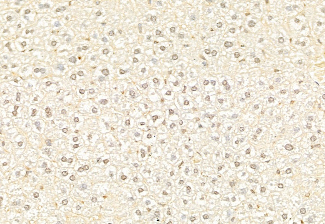 ATF6 Antibody in Immunohistochemistry (Paraffin) (IHC (P))