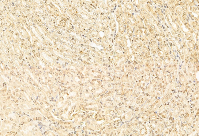 ATF6 Antibody in Immunohistochemistry (Paraffin) (IHC (P))