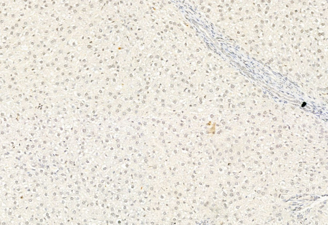 ATF6 Antibody in Immunohistochemistry (Paraffin) (IHC (P))