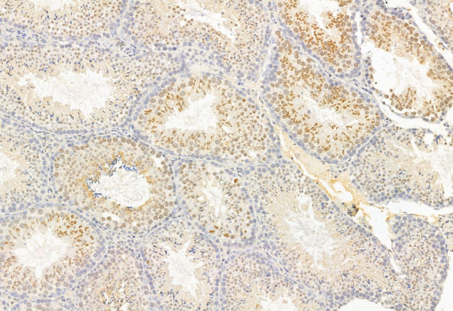 ATF6 Antibody in Immunohistochemistry (Paraffin) (IHC (P))