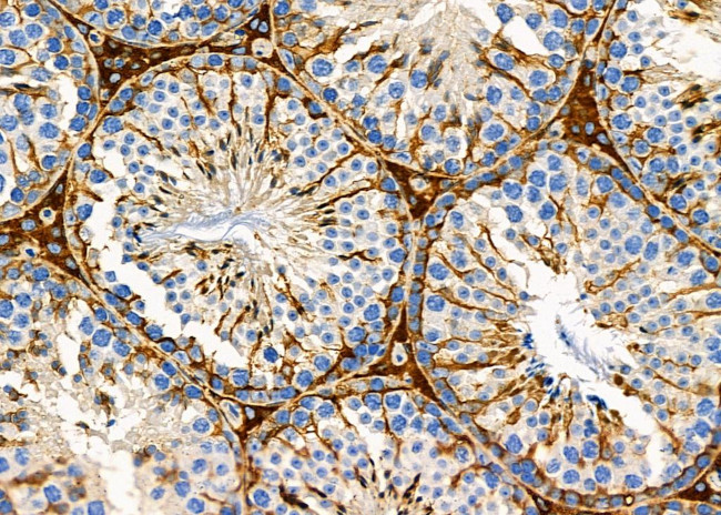 ATXN7L1 Antibody in Immunohistochemistry (Paraffin) (IHC (P))