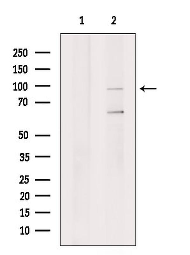 ATXN7L1 Antibody in Western Blot (WB)