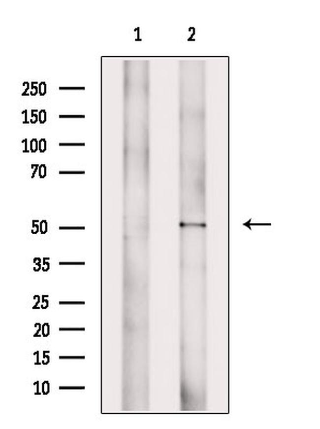 B7-H6 Antibody in Western Blot (WB)