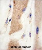 M-cadherin Antibody in Immunohistochemistry (Paraffin) (IHC (P))