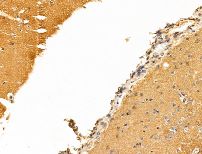 BASP1 Antibody in Immunohistochemistry (Paraffin) (IHC (P))