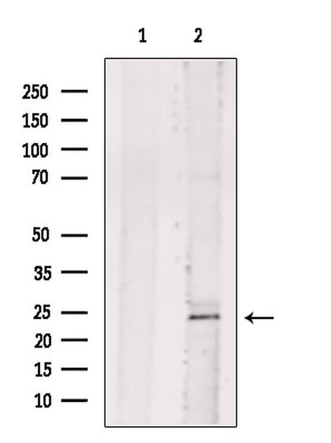 BASP1 Antibody in Western Blot (WB)