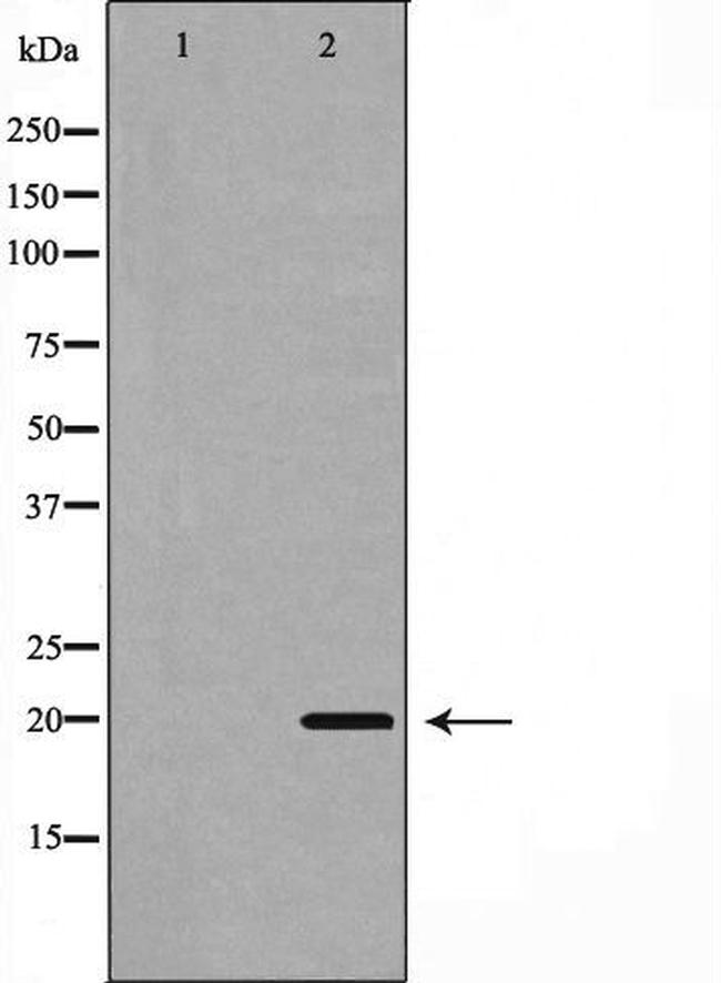 PUMA alpha Antibody in Western Blot (WB)