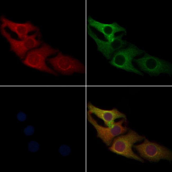 PUMA alpha Antibody in Immunocytochemistry (ICC/IF)