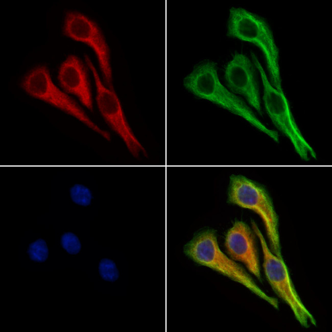 BCKDHA Antibody in Immunocytochemistry (ICC/IF)