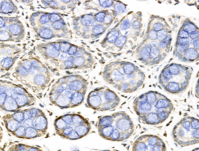 BCKDHA Antibody in Immunohistochemistry (Paraffin) (IHC (P))