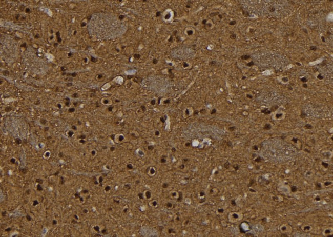 BCL11A Antibody in Immunohistochemistry (Paraffin) (IHC (P))