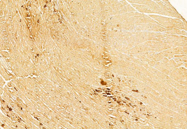 BCL-2 Antibody in Immunohistochemistry (Paraffin) (IHC (P))