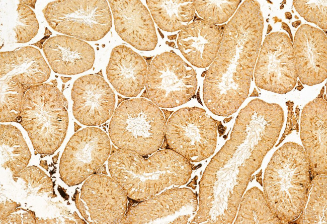 BCL-2 Antibody in Immunohistochemistry (Paraffin) (IHC (P))