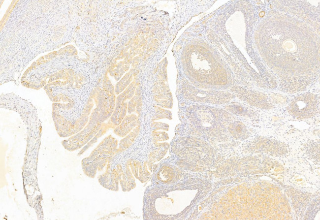 BCL-2 Antibody in Immunohistochemistry (Paraffin) (IHC (P))