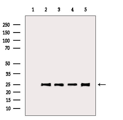 BCL-2 Antibody in Western Blot (WB)