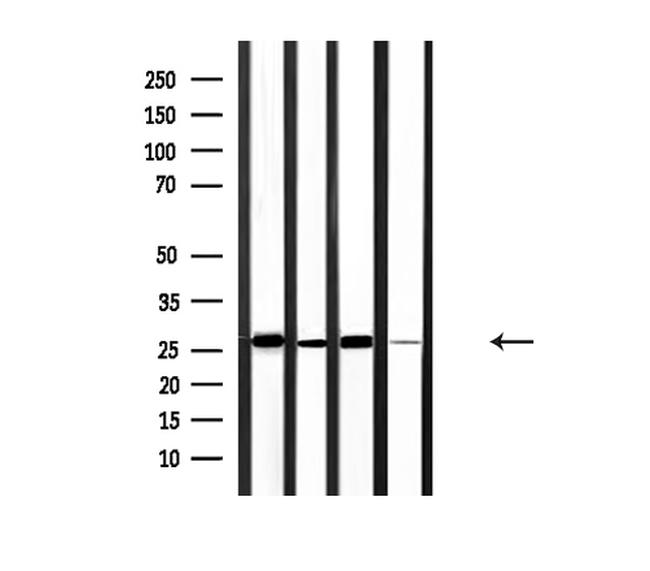 BCL-2 Antibody in Western Blot (WB)