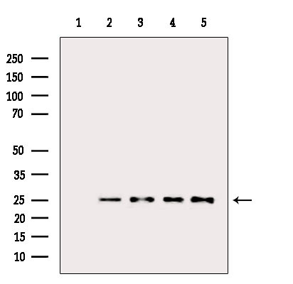 BCL-2 Antibody in Western Blot (WB)