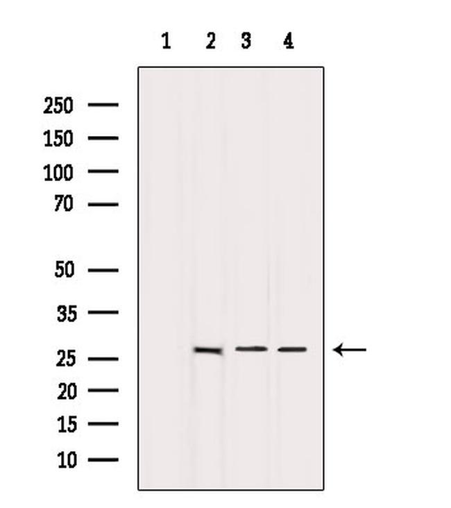 BCL-2 Antibody in Western Blot (WB)