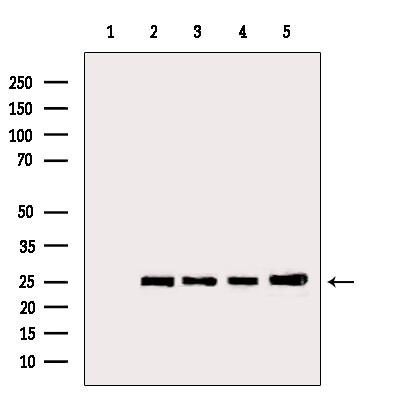 BCL-2 Antibody in Western Blot (WB)