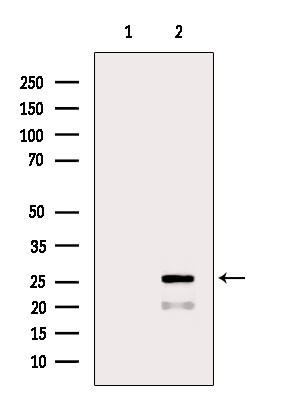 BCL-2 Antibody in Western Blot (WB)