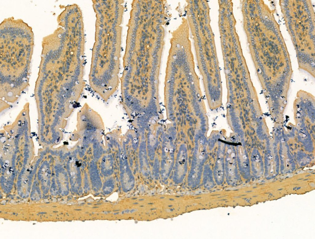 Bestrophin 2 Antibody in Immunohistochemistry (Paraffin) (IHC (P))