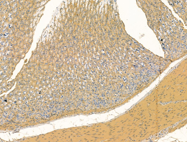 Bestrophin 2 Antibody in Immunohistochemistry (Paraffin) (IHC (P))