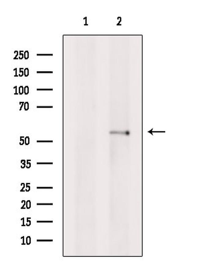 Bestrophin 2 Antibody in Western Blot (WB)