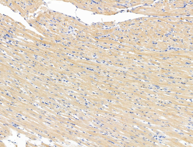 Tubulin beta-2C Antibody in Immunohistochemistry (Paraffin) (IHC (P))