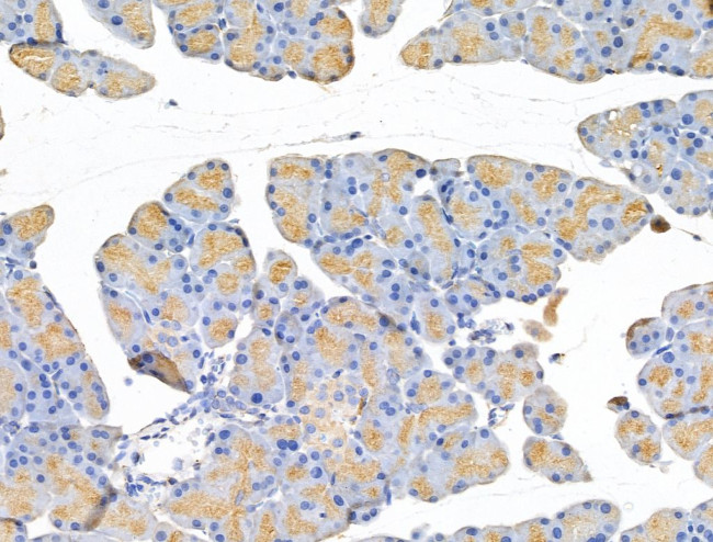 Tubulin beta-2C Antibody in Immunohistochemistry (Paraffin) (IHC (P))