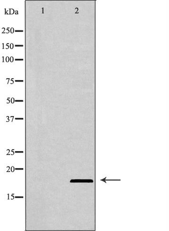 BIK Antibody in Western Blot (WB)